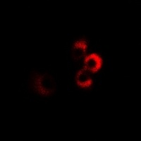 Anti-CPT2 Antibody