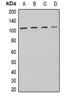 DISC-1 Rabbit Polyclonal Antibody