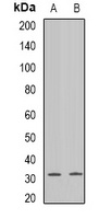 Connexin 31 Rabbit Polyclonal Antibody