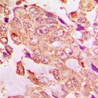 Anti-Kv11.1 Antibody