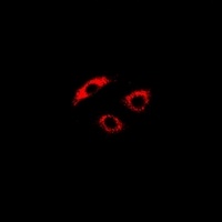 Anti-PDK4 Antibody