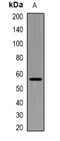 ASCT1 Rabbit Polyclonal Antibody