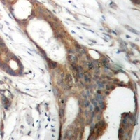 Anti-ASCT1 Antibody