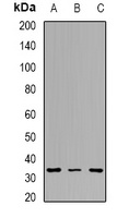 Tropomyosin 2 Rabbit Polyclonal Antibody