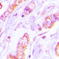 Anti-Tropomyosin 2 Antibody