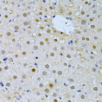 Anti-FBXO32 Antibody