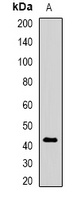 FucT-VI Rabbit Polyclonal Antibody