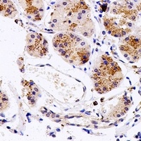 FucT-VI Rabbit Polyclonal Antibody