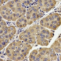 Anti-UQCRC2 Antibody
