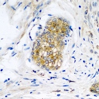 Neuroligin Y Rabbit Polyclonal Antibody