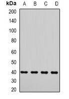 LIC3 Rabbit Polyclonal Antibody