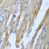 Anti-RRM2 Antibody