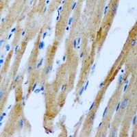 RRM2 antibody