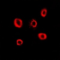 Anti-RRM2 Antibody