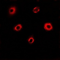 Anti-eIF4A1 Antibody