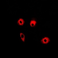 Anti-ABAT Antibody