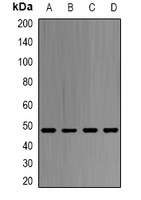 SAHH Rabbit Polyclonal Antibody