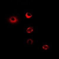 Anti-CPT1A Antibody