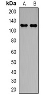 NBC1 Rabbit Polyclonal Antibody