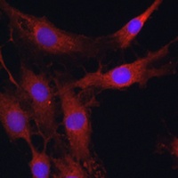 Anti-NBC1 Antibody
