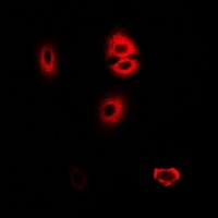 Anti-HADHA Antibody