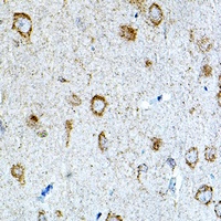 Anti-IL-1R3 Antibody