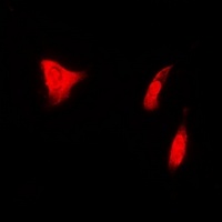 Anti-PSMD7 Antibody