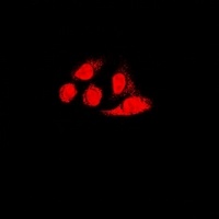 Anti-PA28 alpha Antibody