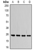VAP-B/C Rabbit Polyclonal Antibody
