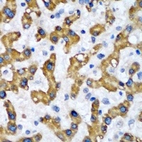 Anti-VAP-B/C Antibody