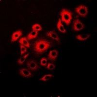 VAPB antibody