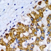 SCP2 antibody