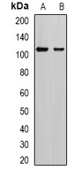 AP2-alpha-2 Rabbit Polyclonal Antibody