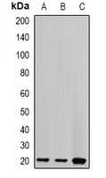 Centrin-2 Rabbit Polyclonal Antibody
