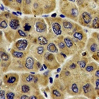 Anti-DLD Antibody
