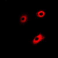 Anti-DLD Antibody