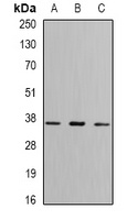 FBP1 Rabbit Polyclonal Antibody