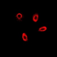 Anti-FBP1 Antibody