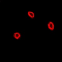 Anti-NPC2 Antibody