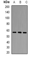 PCCB Antibody