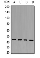SCCA1 Rabbit Polyclonal Antibody