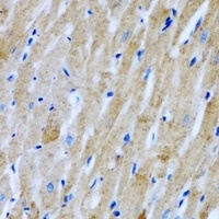 Anti-GlyRS Antibody