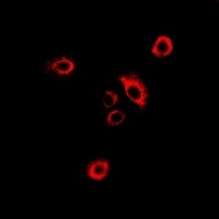 Anti-GlyRS Antibody