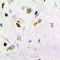 PSMB10 antibody