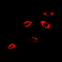 Anti-APRT Antibody