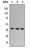 FHL-1 Rabbit Polyclonal Antibody