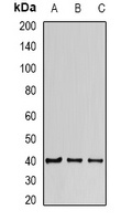 FIH-1 Rabbit Polyclonal Antibody