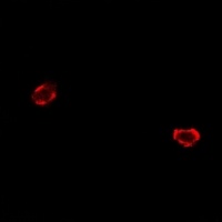 Anti-FIH-1 Antibody