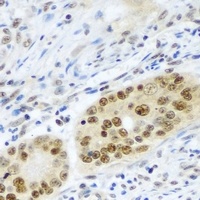 PSMB2 antibody