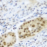 Anti-PSMB2 Antibody